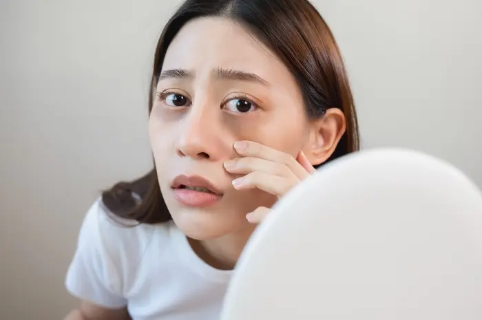 Cara Efektif Menghilangkan Kantung Mata dan Mata Panda